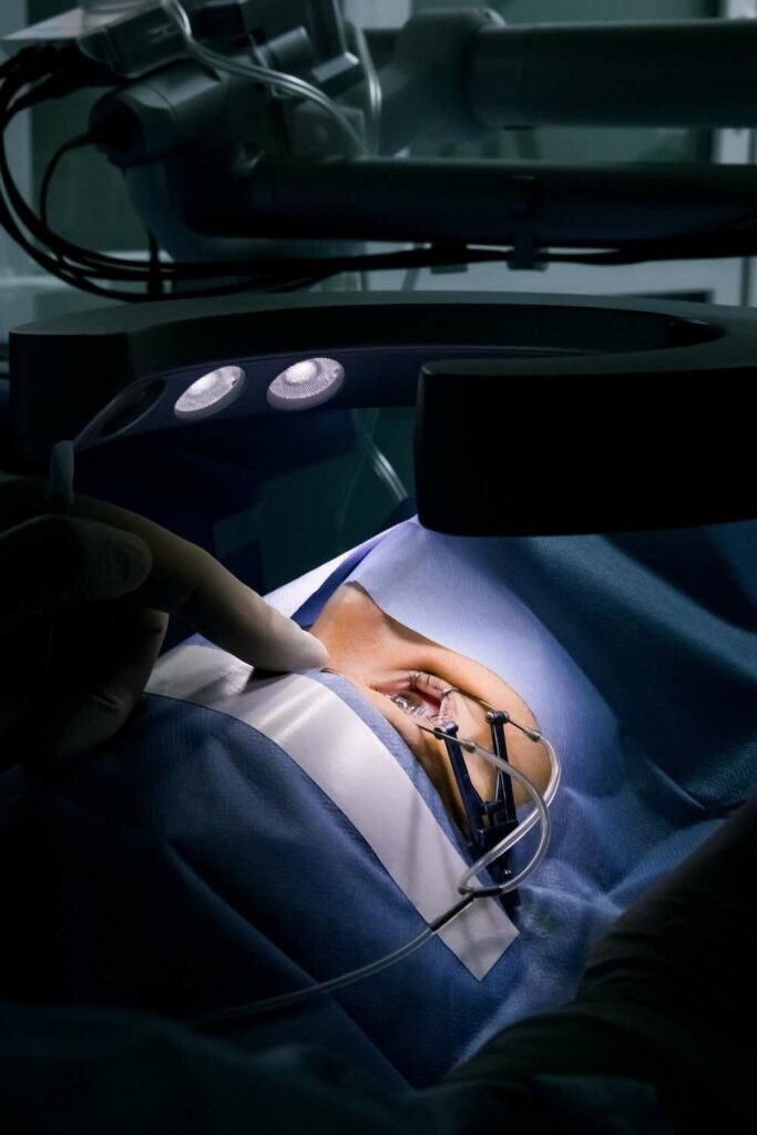 cataract surgery