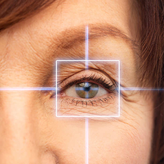 eye cataract surgery